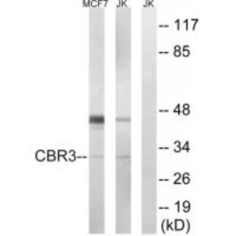 Western blot - CBR3 Antibody from Signalway Antibody (34545) - Antibodies.com