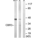 Western blot - CBR3 Antibody from Signalway Antibody (34545) - Antibodies.com