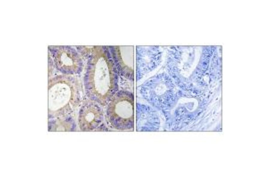 Immunohistochemistry - CBR3 Antibody from Signalway Antibody (34545) - Antibodies.com