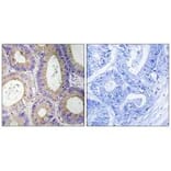 Immunohistochemistry - CBR3 Antibody from Signalway Antibody (34545) - Antibodies.com