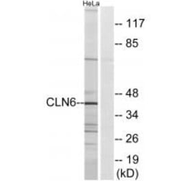 Western blot - CLN6 Antibody from Signalway Antibody (34576) - Antibodies.com