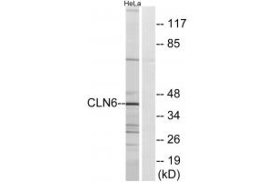 Western blot - CLN6 Antibody from Signalway Antibody (34576) - Antibodies.com