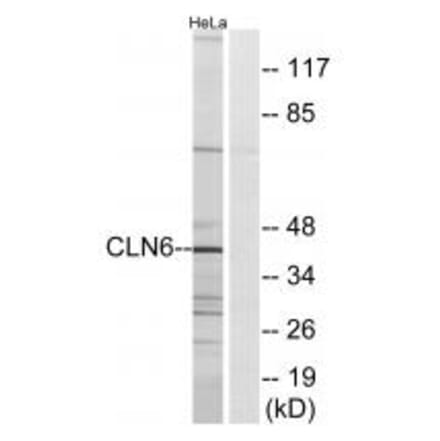 Western blot - CLN6 Antibody from Signalway Antibody (34576) - Antibodies.com