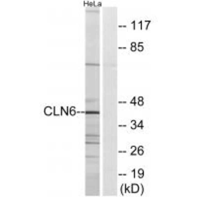 Western blot - CLN6 Antibody from Signalway Antibody (34576) - Antibodies.com