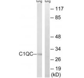 Western blot - C1QC Antibody from Signalway Antibody (34608) - Antibodies.com