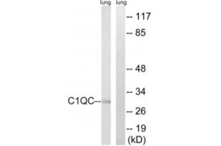 Western blot - C1QC Antibody from Signalway Antibody (34608) - Antibodies.com