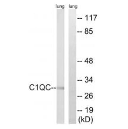 Western blot - C1QC Antibody from Signalway Antibody (34608) - Antibodies.com