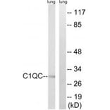 Western blot - C1QC Antibody from Signalway Antibody (34608) - Antibodies.com