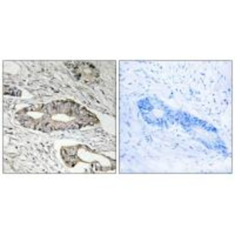 Immunohistochemistry - EPN3 Antibody from Signalway Antibody (34678) - Antibodies.com