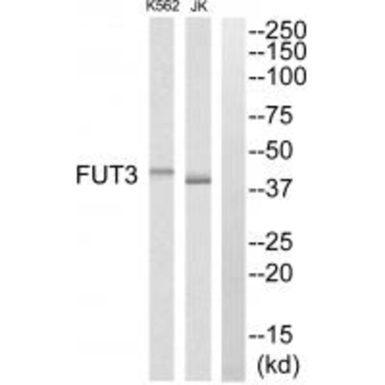 Western blot - FUT3 Antibody from Signalway Antibody (34693) - Antibodies.com