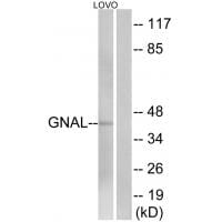 Western blot analysis of extracts from LOVO cells, using GNAL antibody #34727.
