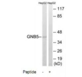 Western blot - GNB5 Antibody from Signalway Antibody (34730) - Antibodies.com