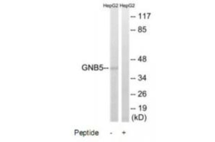 Western blot - GNB5 Antibody from Signalway Antibody (34730) - Antibodies.com