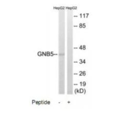 Western blot - GNB5 Antibody from Signalway Antibody (34730) - Antibodies.com