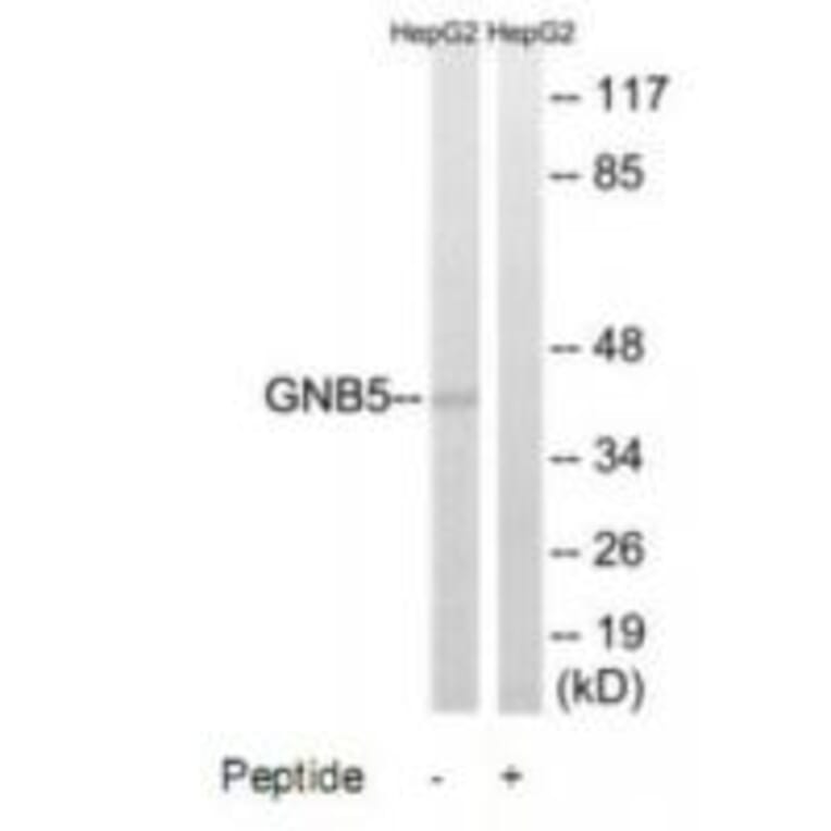 Western blot - GNB5 Antibody from Signalway Antibody (34730) - Antibodies.com