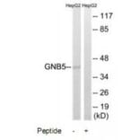 Western blot - GNB5 Antibody from Signalway Antibody (34730) - Antibodies.com