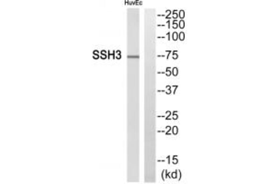 Western blot - SSH3 Antibody from Signalway Antibody (34935) - Antibodies.com