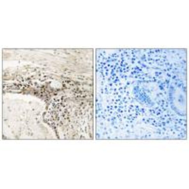 Immunohistochemistry - SSH3 Antibody from Signalway Antibody (34935) - Antibodies.com