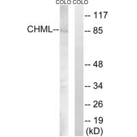 Western blot analysis of extracts from COLO cells, using CHML antibody #34948.
