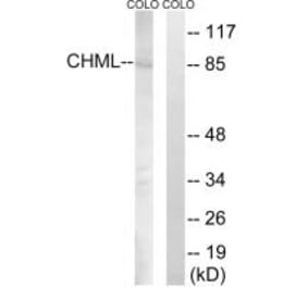 Western blot - CHML Antibody from Signalway Antibody (34948) - Antibodies.com