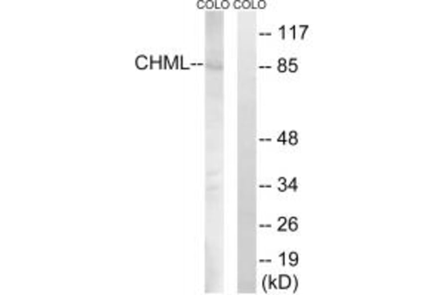Western blot - CHML Antibody from Signalway Antibody (34948) - Antibodies.com