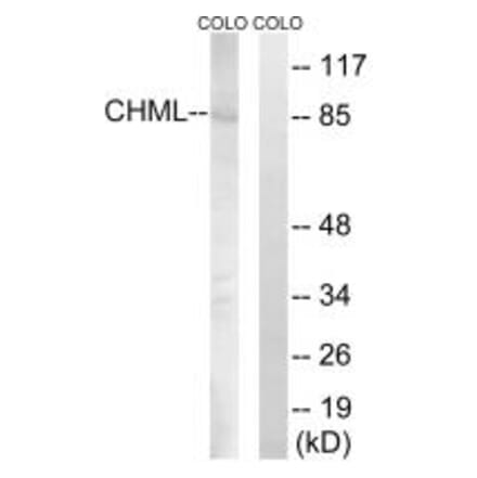 Western blot - CHML Antibody from Signalway Antibody (34948) - Antibodies.com