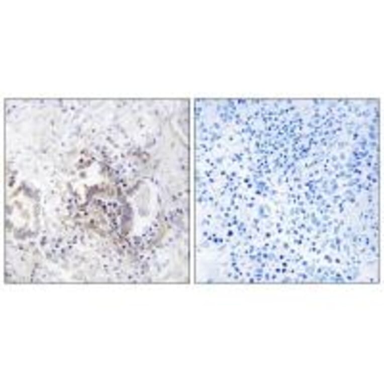 Immunohistochemistry - CHML Antibody from Signalway Antibody (34948) - Antibodies.com