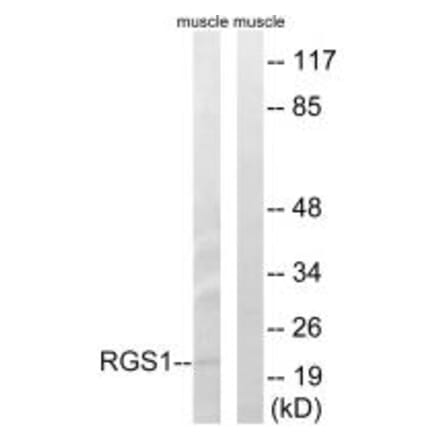 Western blot - RGS1 Antibody from Signalway Antibody (34979) - Antibodies.com