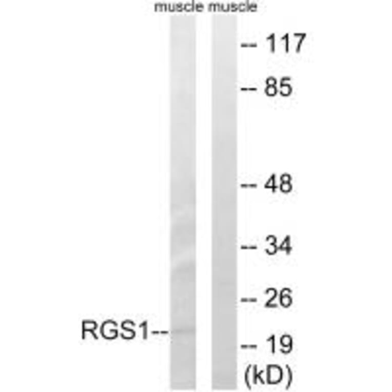 Western blot - RGS1 Antibody from Signalway Antibody (34979) - Antibodies.com