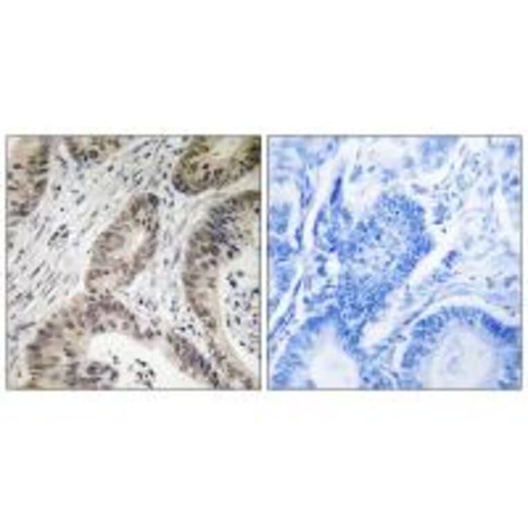 Immunohistochemistry - TUT1 Antibody from Signalway Antibody (35114) - Antibodies.com