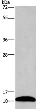Gel: 12% SDS-PAGE Lysates (from left to right): Mouse brain tissue Amount of lysate: 40ug per lane Primary antibody: 1/1000 dilution Secondary antibody dilution: 1/8000 Exposure time: 2 minutes