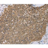 Immunohistochemistry - PCP4 Antibody from Signalway Antibody (35549) - Antibodies.com