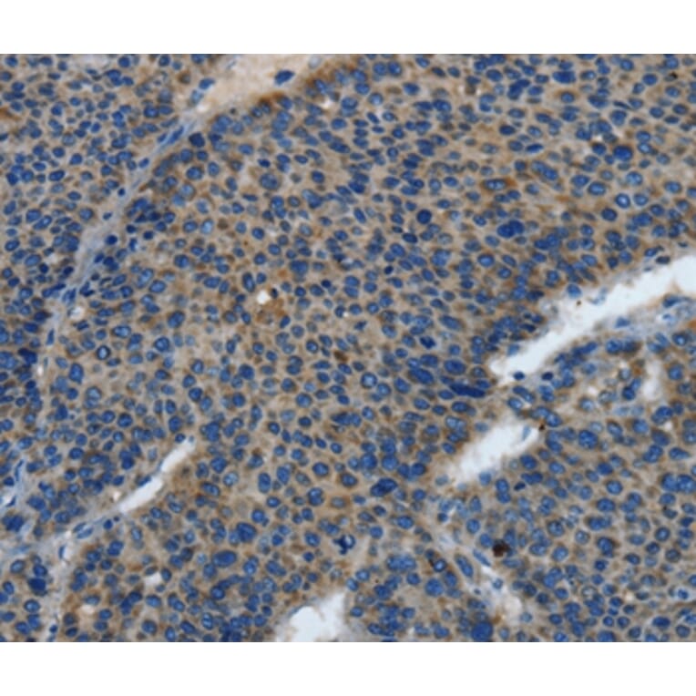 Immunohistochemistry - TLR4 Antibody from Signalway Antibody (35577) - Antibodies.com