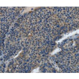 Immunohistochemistry - TLR4 Antibody from Signalway Antibody (35577) - Antibodies.com