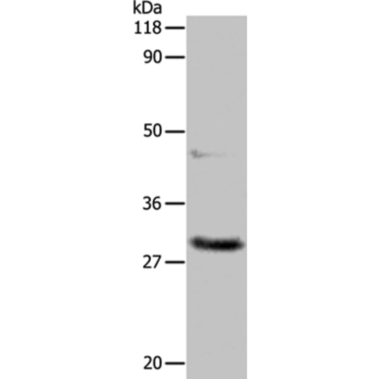 APIP Antibody from Signalway Antibody (35591) - Antibodies.com