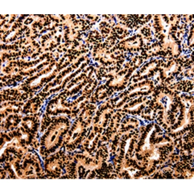 Immunohistochemistry - APIP Antibody from Signalway Antibody (35591) - Antibodies.com