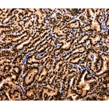 Immunohistochemistry - APIP Antibody from Signalway Antibody (35591) - Antibodies.com