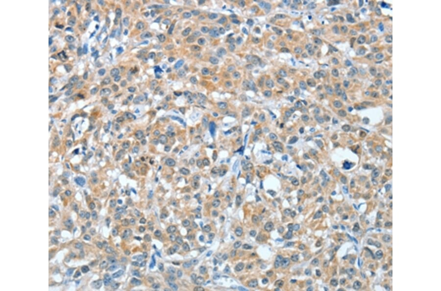 Immunohistochemistry - BAG3 Antibody from Signalway Antibody (35593) - Antibodies.com
