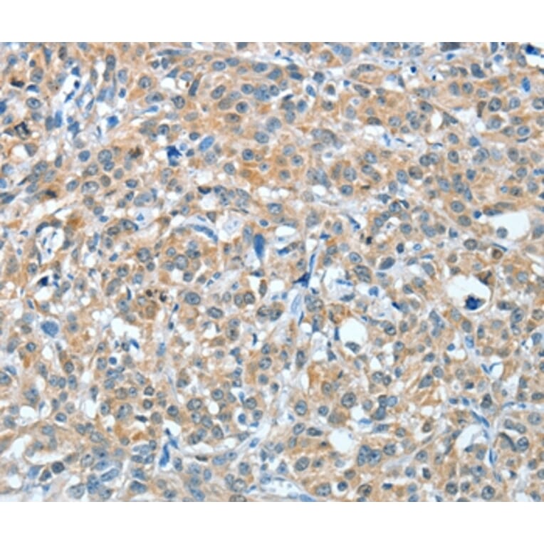 Immunohistochemistry - BAG3 Antibody from Signalway Antibody (35593) - Antibodies.com