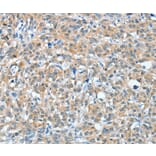 Immunohistochemistry - BAG3 Antibody from Signalway Antibody (35593) - Antibodies.com
