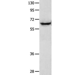 KRT2 Antibody from Signalway Antibody (35627) - Antibodies.com