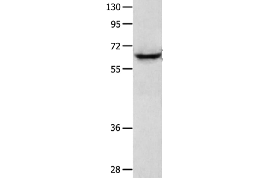 KRT2 Antibody from Signalway Antibody (35627) - Antibodies.com