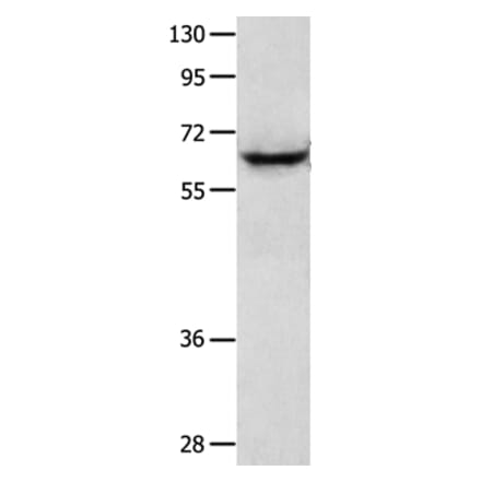 KRT2 Antibody from Signalway Antibody (35627) - Antibodies.com