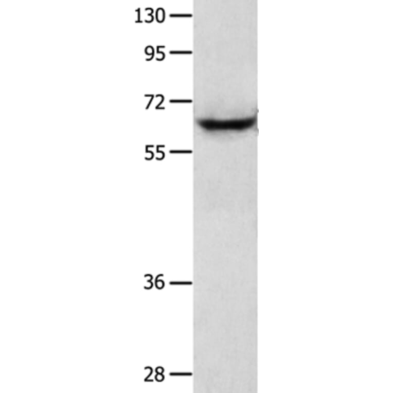 KRT2 Antibody from Signalway Antibody (35627) - Antibodies.com