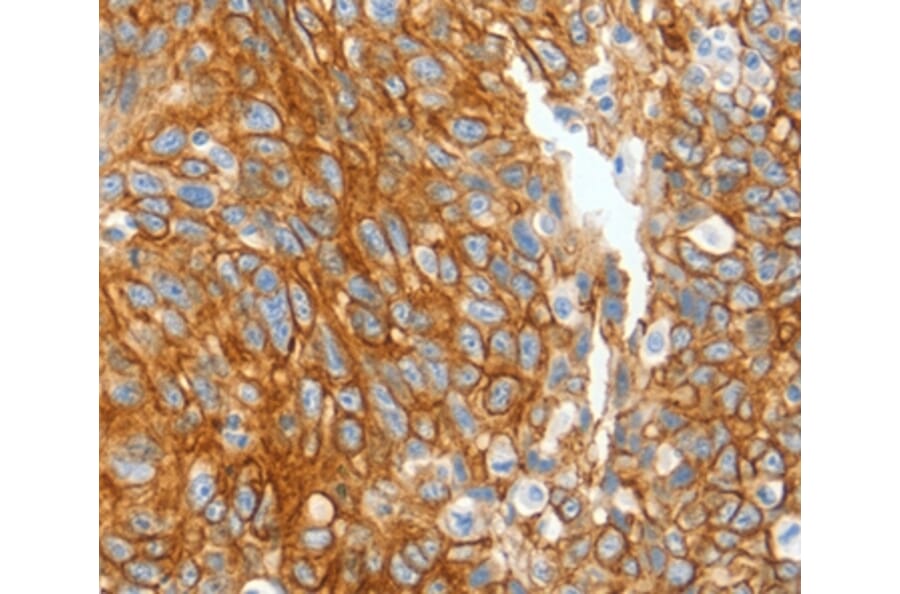 Immunohistochemistry - KRT2 Antibody from Signalway Antibody (35627) - Antibodies.com