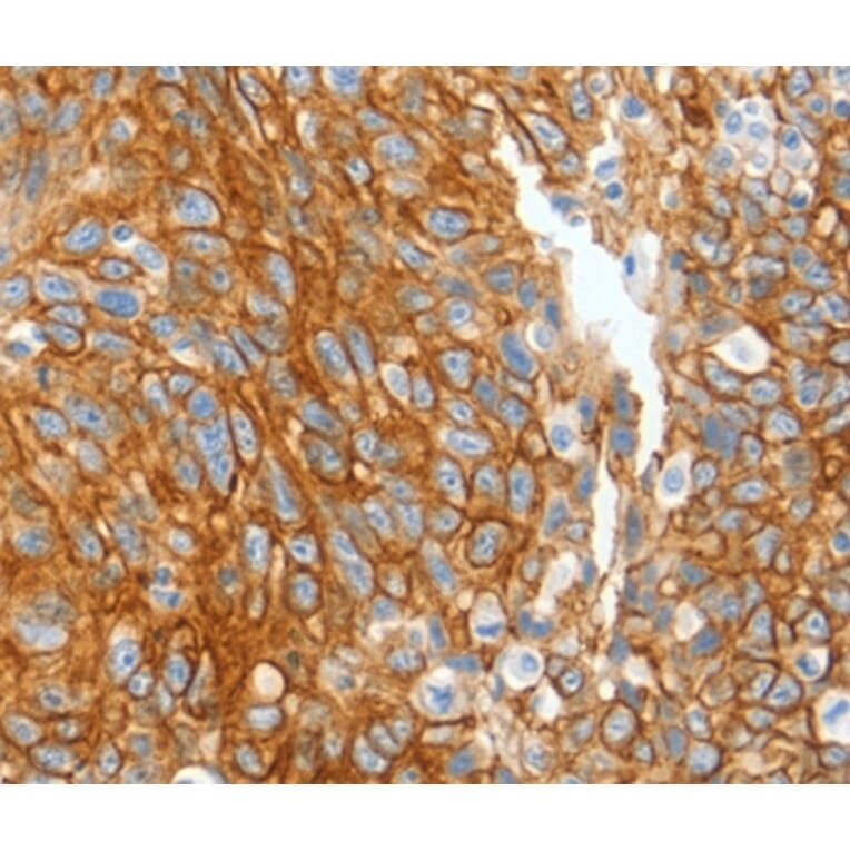 Immunohistochemistry - KRT2 Antibody from Signalway Antibody (35627) - Antibodies.com