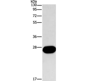 FGF9 Antibody from Signalway Antibody (35651) - Antibodies.com
