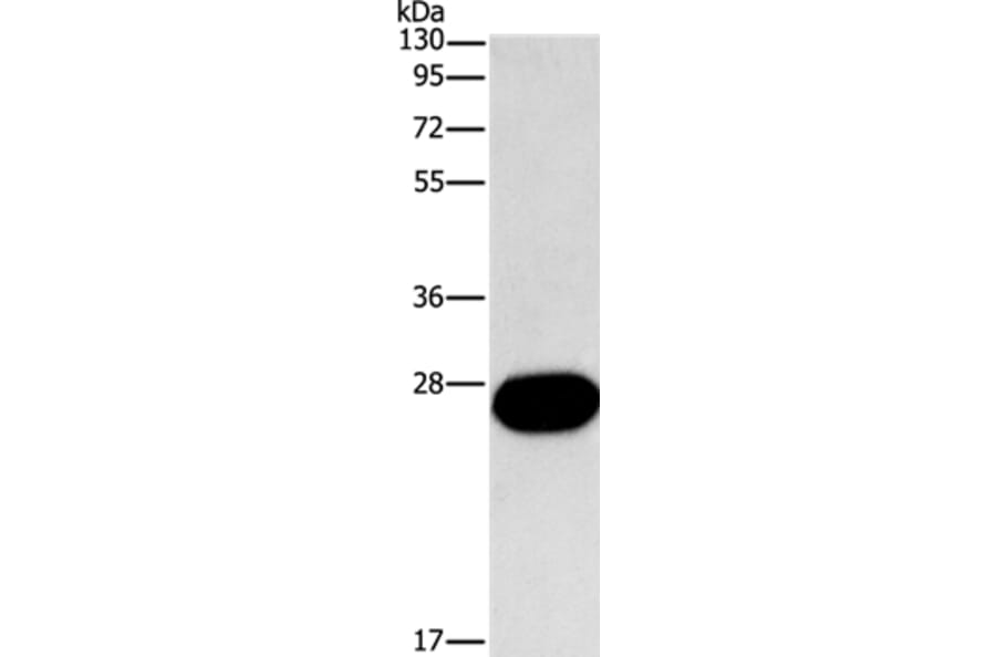 FGF9 Antibody from Signalway Antibody (35651) - Antibodies.com