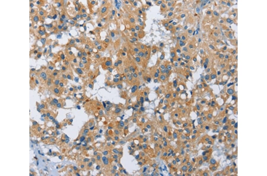 Immunohistochemistry - FGF9 Antibody from Signalway Antibody (35651) - Antibodies.com