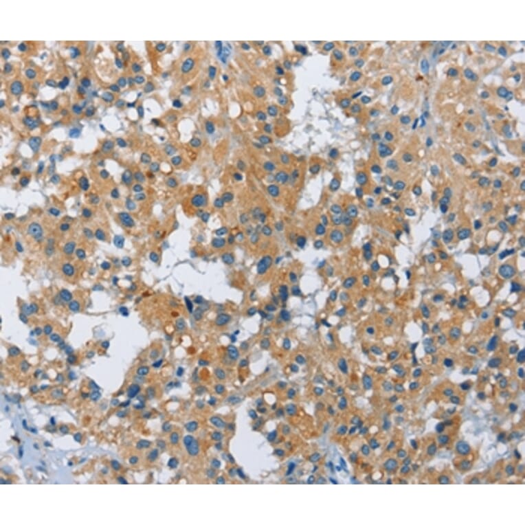 Immunohistochemistry - FGF9 Antibody from Signalway Antibody (35651) - Antibodies.com